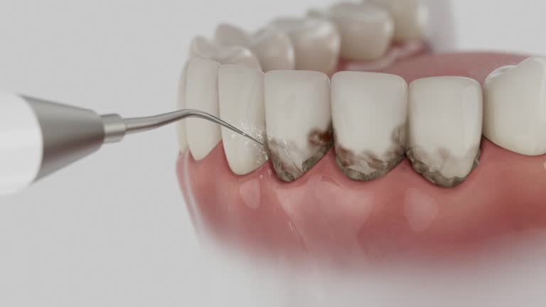 Reliable Dental Implants contractor in Delmar, DE by Smile Center Dentistry